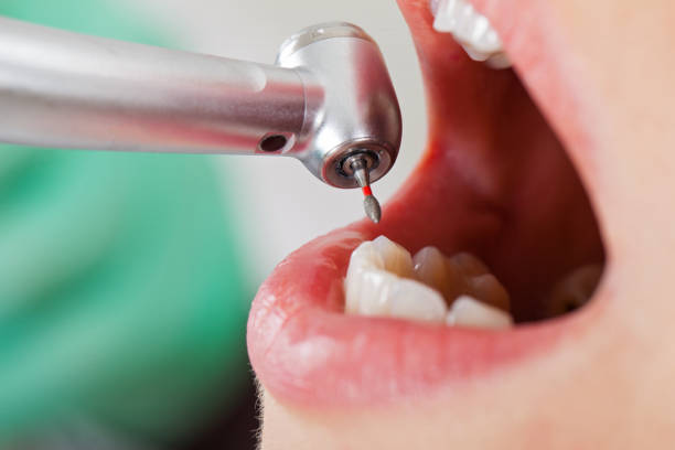 Best Emergency Treatment for Dental Infections or Abscesses in Ringwood, NJ